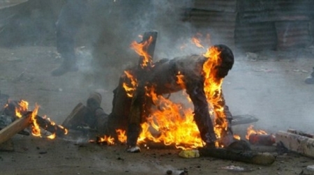 موظف في بلدية المفرق يشعل النار بجسده وحالته سيئة