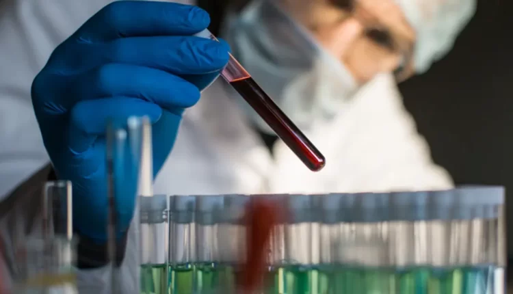 الصحة المصرية تكشف جديد "المرض الغامض" الذي ظهر بقرية الصعيد